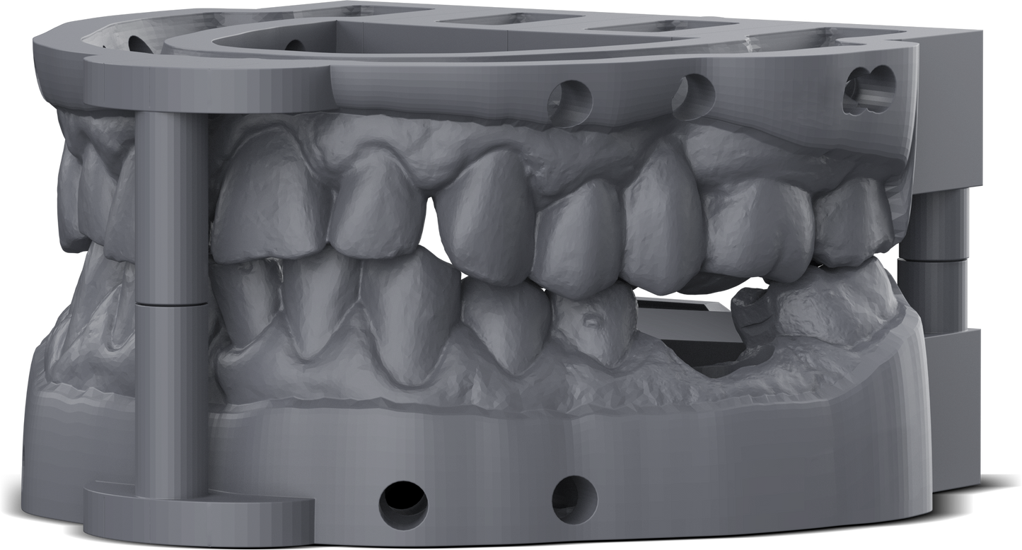 Dental Model Slate - 1kg
