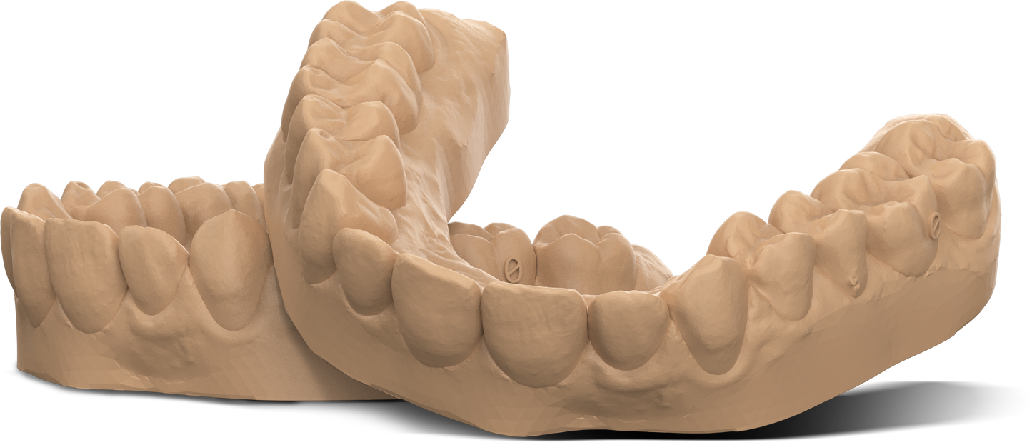 Dental Model Stone - 1kg