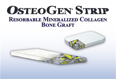 OsteoGen® Strips - Resorbable Mineralized Collagen Bone Graft